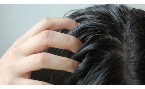 CAPELLI GRASSI E SEBORREA: QUALI SONO I RIMEDI PIU’ EFFICACI?